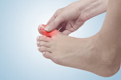 foot pain 1 A Step-by-Step Guide to Filing a Cartiva Lawsuit