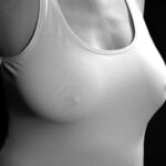 Breast Cancer Due to AFFF
